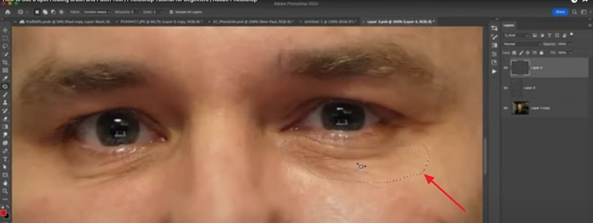 specify area to add patch there