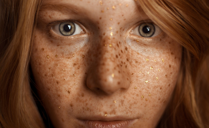 real-life-imperfection-photography-candid-portrait-with-natural-skin-and-raw-everyday-moments