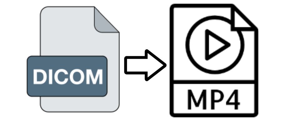 [Step-by-Step] Best 2 Methods to Convert DCM to MP4
