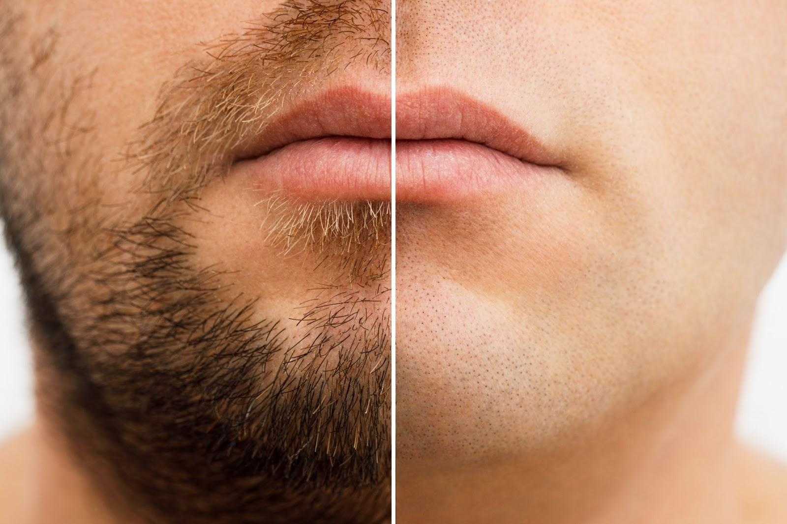 Top AI Beard Remover Tools to Remove Facial Hair from Photos