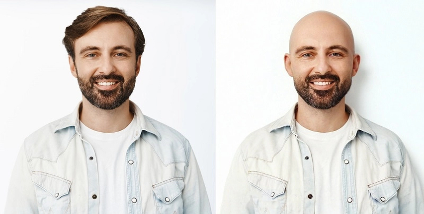 a girl with bald look preview