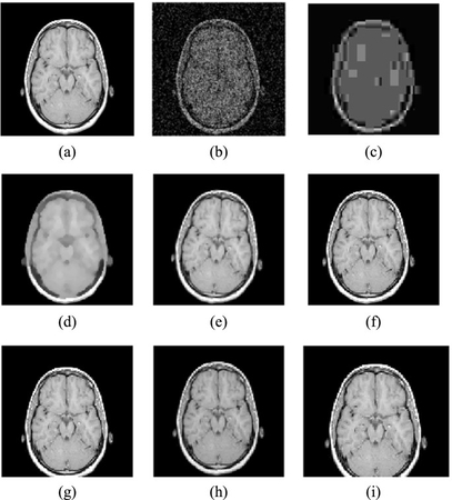 gaussian noise in medical images